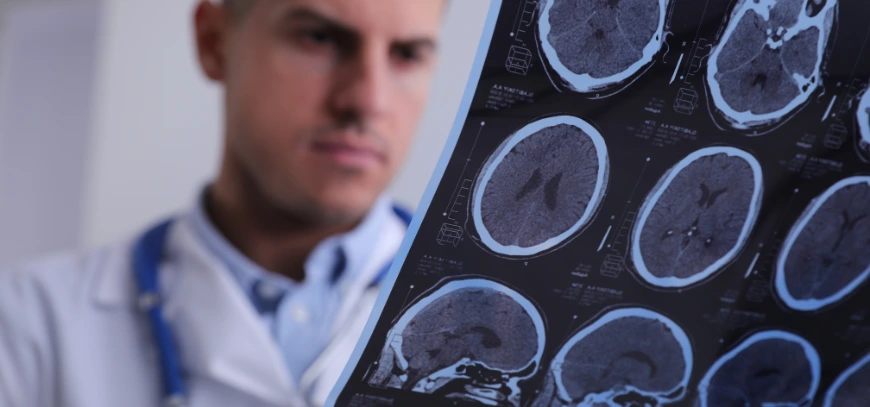 seizure-epilepsy service by neumed clinic